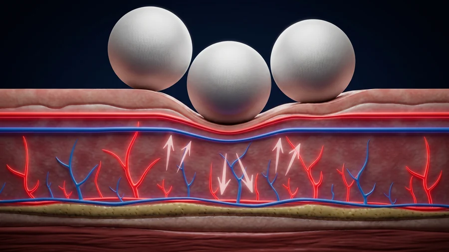 Vaskulární stimulace Endospheres — rotace sfér aktivuje prokrvení a výměnu látek